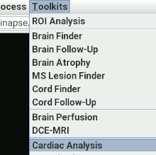 Launching the Cardiac Analysis tool