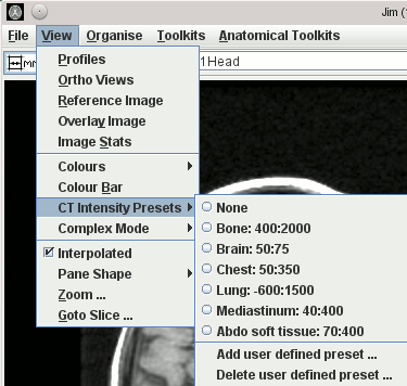 CT presets on the View menu