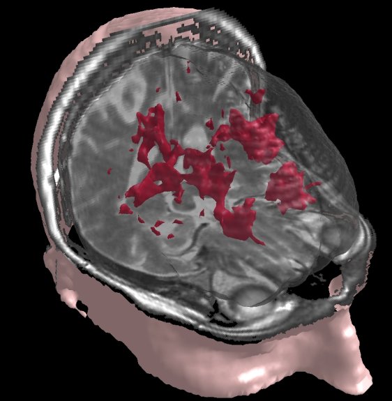 3d_mri