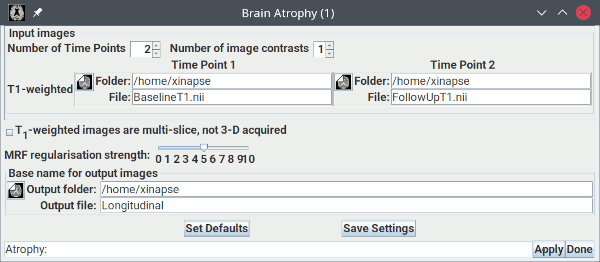 Setup for longitudinal brain atrophy assessment