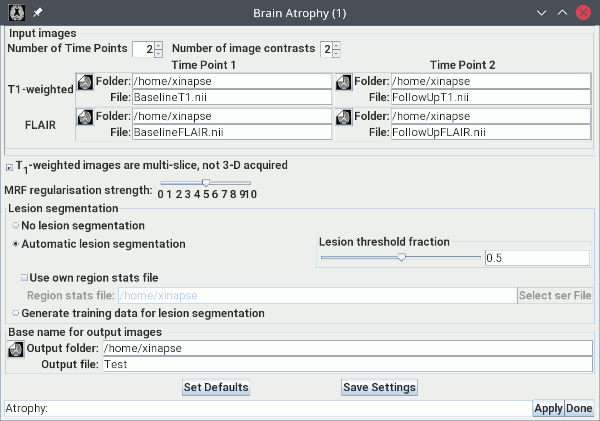 Setup for longitudinal brain atrophy assessment with lesions