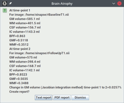 Results for longitudinal brain atrophy assessment