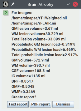 Results for cross-sectional brain atrophy assessment with
                           lesions