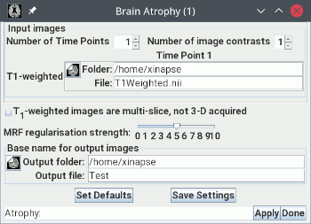 Setup for cross-sectional brain atrophy assessment