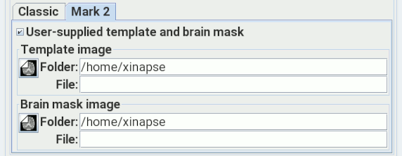 The Brain Finder Mark 2 method with a
                                        user-supplied template