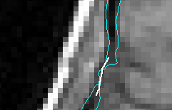 brain_scalp_bridge