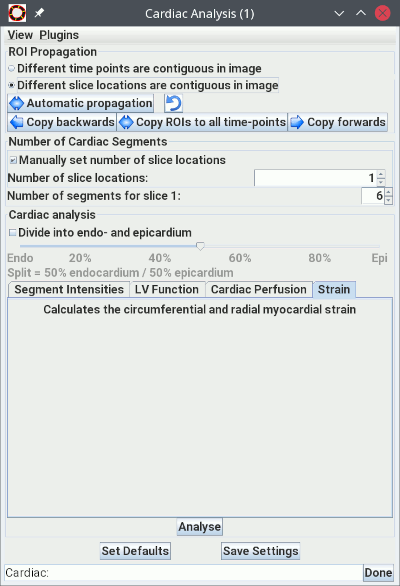 The Cardiac Segmental Analysis tool