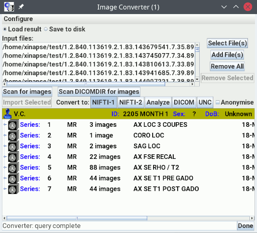 The Medical Image Converter tool showing a
                                  tree of images