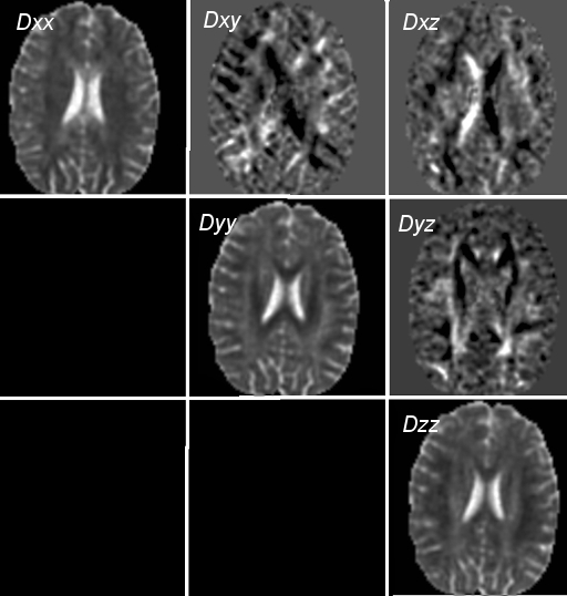 Diffusion tensor elements image