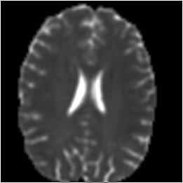 M0 intensity image