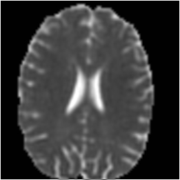 Diffusion tensor trace image