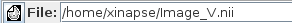 Selecting the vector fields image for diffeomorphic registration