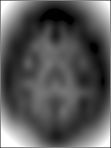 Bias field with the
                                                level-of-detail set to 5