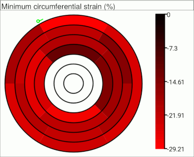 Bullseye plot of minimum circumferential strain