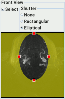 The MIP elliptical shutter