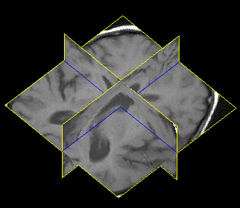 mpr_ortho