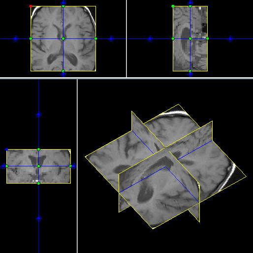 mpr_pane_resized