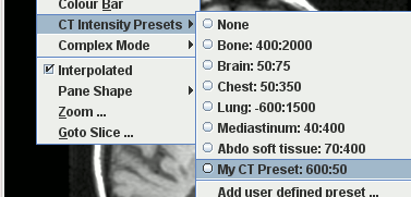 CT intensity preset added to the View Menu