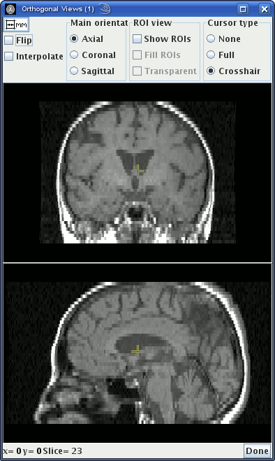 ortho_views_dialog