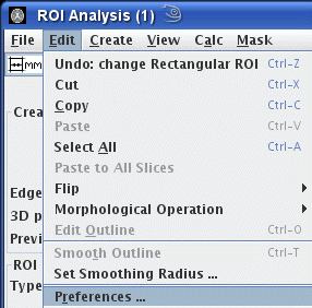 roi_edit_preferences