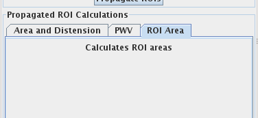 ROI Propagation tool with the
                                                                imported plugin