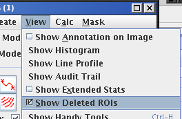 show_deleted_rois