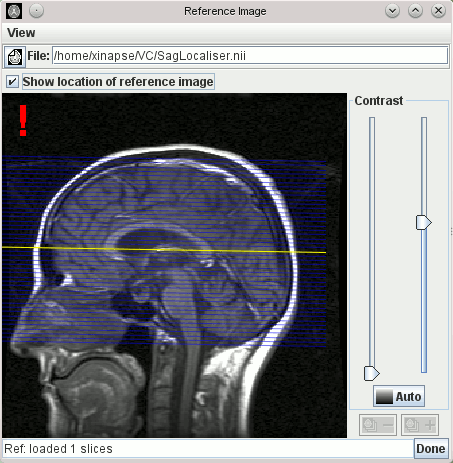 slice_centre_display