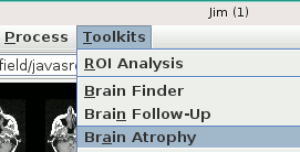 Launching the Brain Atrophy tool