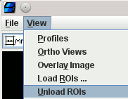 view_unload_rois