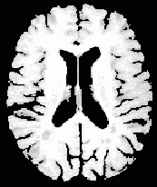 particle_brain